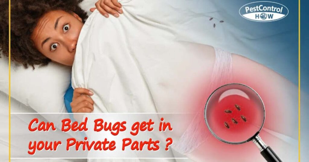 Bed Bugs Go In Your Private Parts