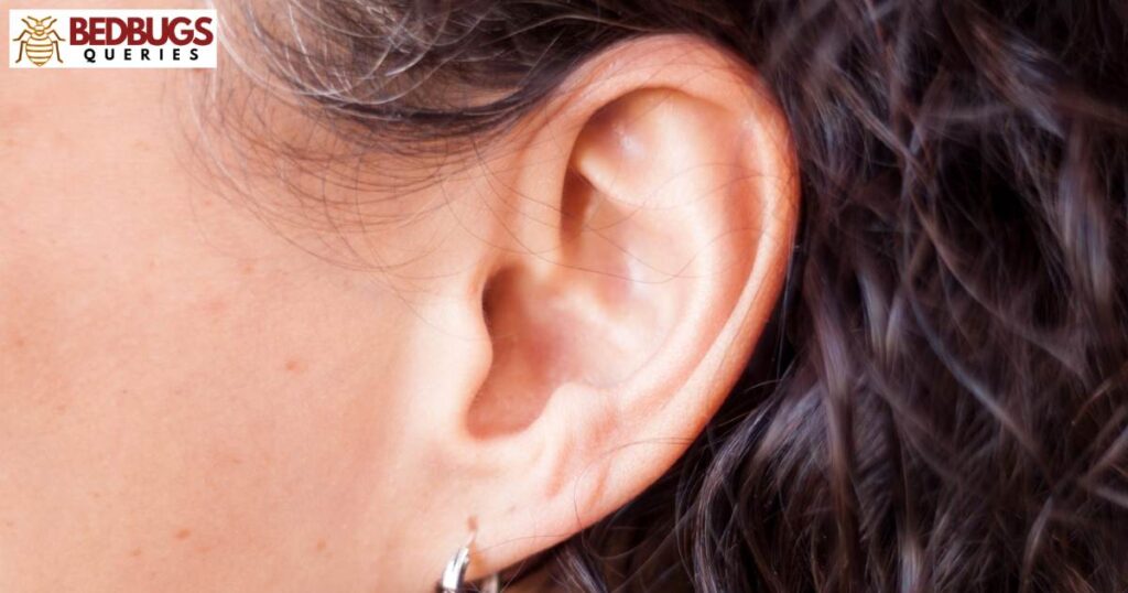 Do Bed Bugs Lay Eggs In Your Ear 